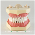 32 pcs Dentes Removíveis de Silicone Gum Ensinar Modelo Dental 13008, Dentes de Substituição Siut para Frasaco Jaw